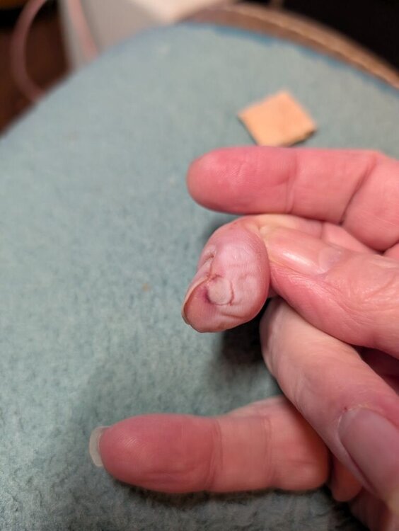 ouchie_finger.thumb.jpg.8d59b0288bdf03fd07621439e62c565b.jpg